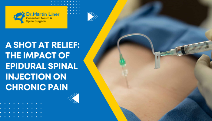 spinal injection